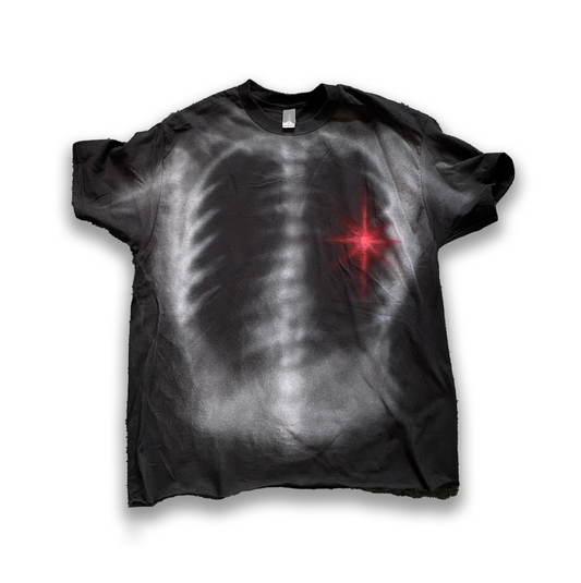 Xray tee